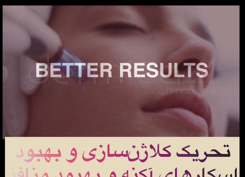 تحریک کلاژن سازی