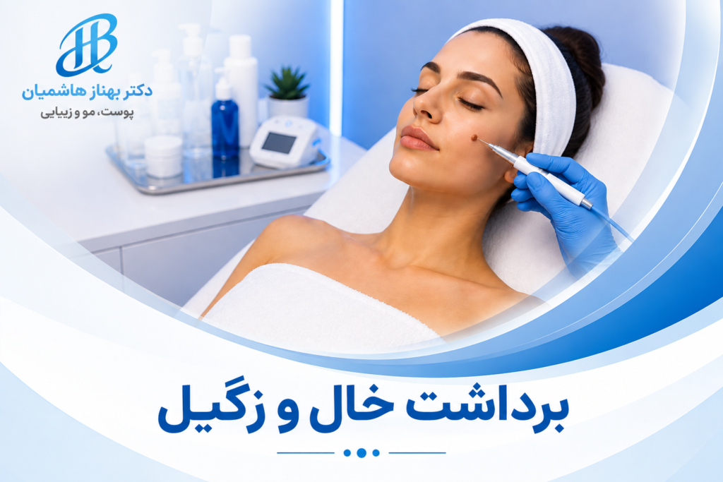 برداشت خال و زگیل